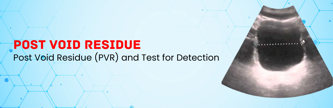 Post Void Residue (PVR) and Test for Detection